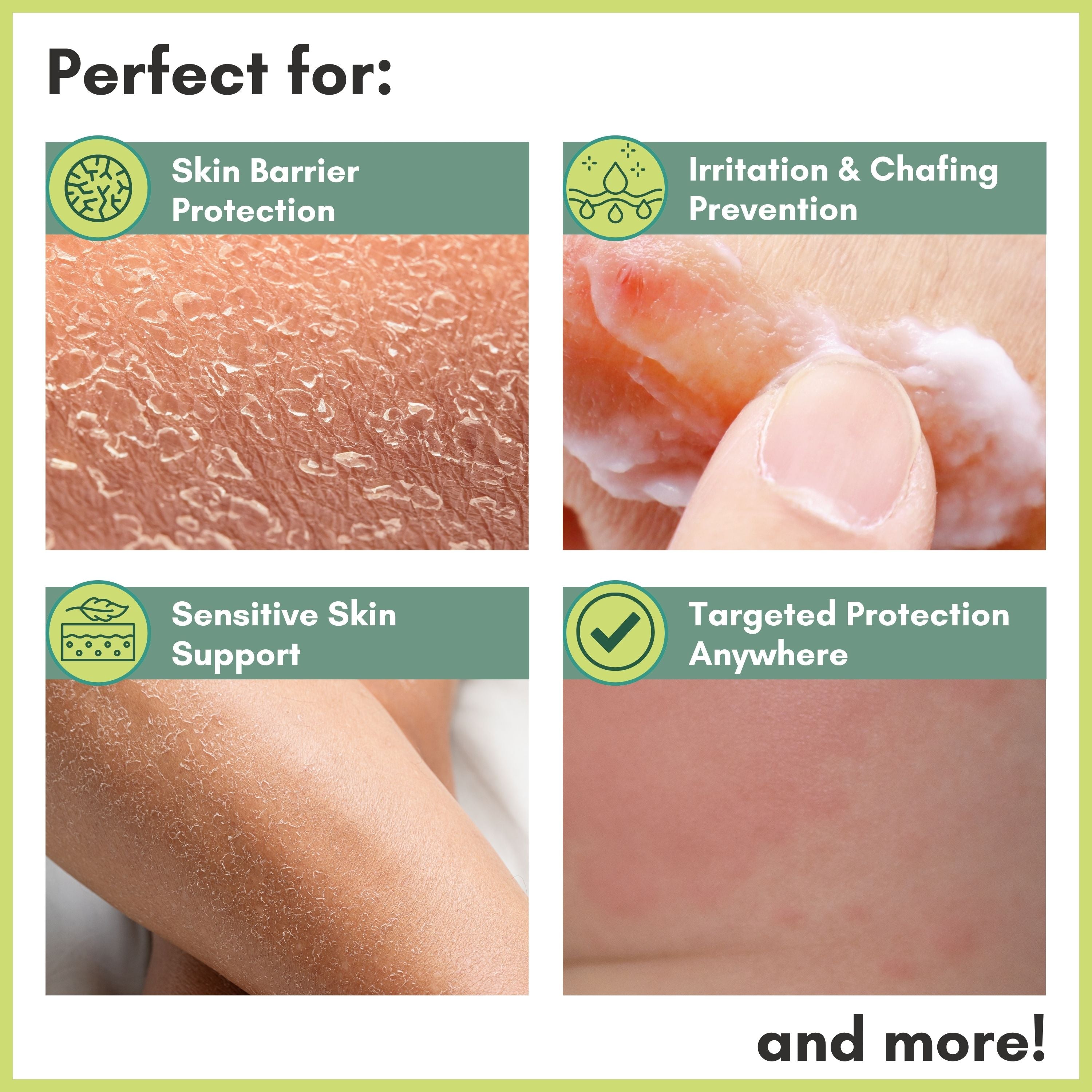Barrier Cream